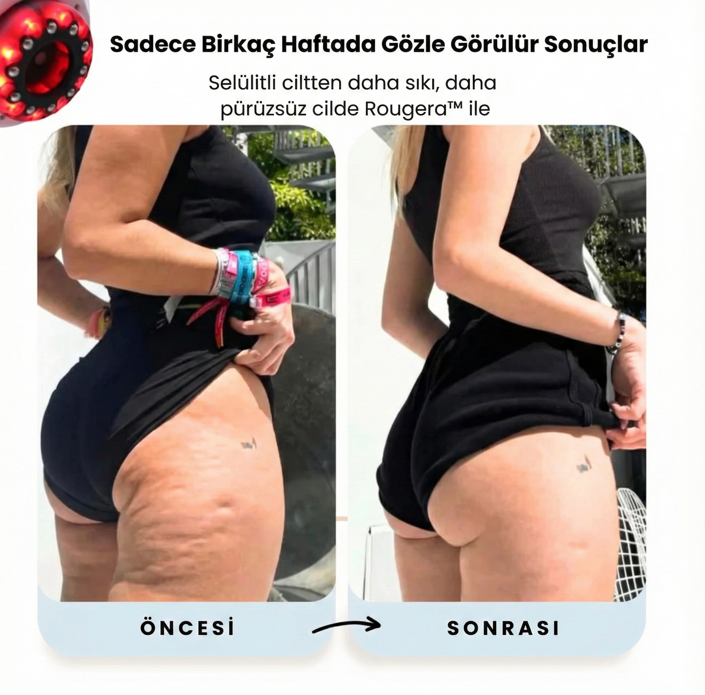 Rougera™ Yeni Nesil Selülit, Yağlanma, Lipödem giderici Masaj Aleti